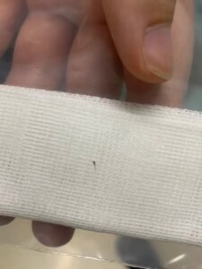 Close-up of a small bee stinger visible on a white gauze bandage held by a hand after being removed