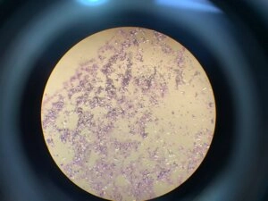 Microscope view showing clustered microscopic particles and crystal formations within a circular lens field