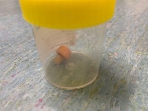 Small foam Nerf dart stored inside a clear specimen container with a yellow lid